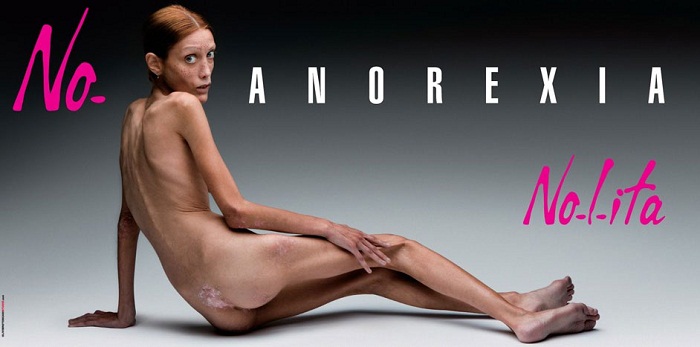 anorexia_.jpg (.35 Kb)