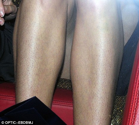 6234_article13258300bdf011f000005dc296_468x421.jpg (50.18 Kb) 6234_article13258300bdf011f000005dc296_468x421.jpg (50.18 Kb)